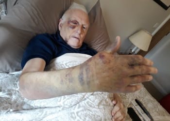 Pensioner brutally attacked in his garden