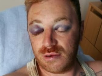 Man hurt in Carlisle bar attack