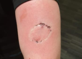 Man arrested after police officer bitten