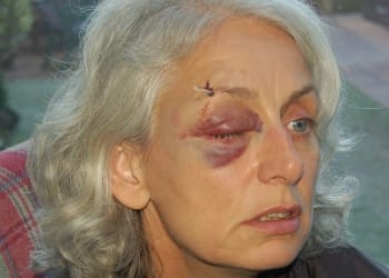 Carlisle man admits assaulting female police officer