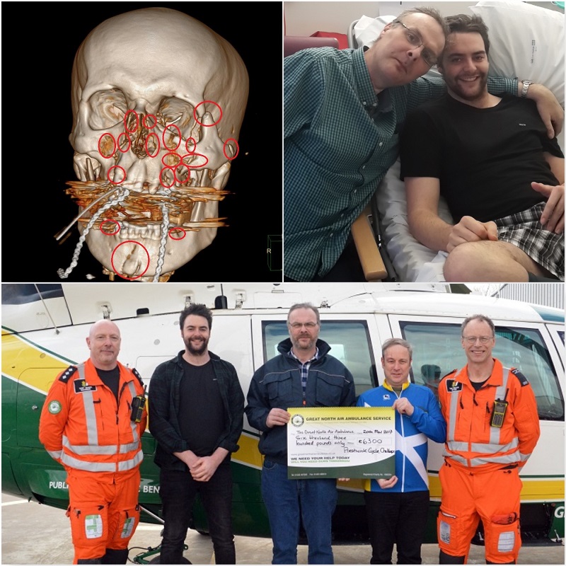 Clockwise: Andy's facial injuries, Andy and Alex in hospital and Paramedic Terry Sharpe, Alex Cross, Andy Robinson, Kevin Coventry of Prestwick Cycle Challenge and Dr Theo Weston
