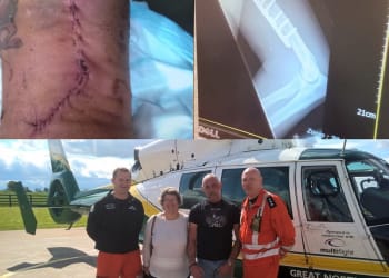 Man crushed in Workington paper baler thanks rescuers