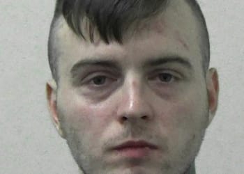 Violent thug jailed after assault leaves victim missing part of his skull