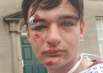 Biker, 14, saved by helmet after back wheel comes off