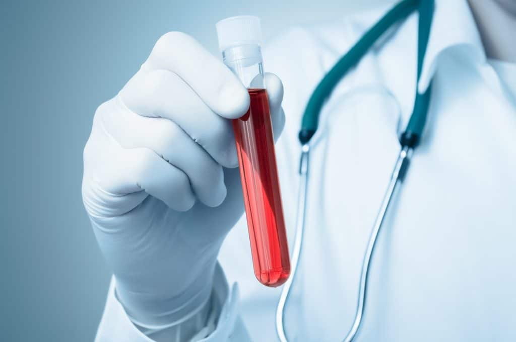 Carlisle has been selected within the North East and North Cumbria area to take part in the world’s largest trial of a revolutionary new blood test that can detect more than 50 types of cancer before symptoms appear.