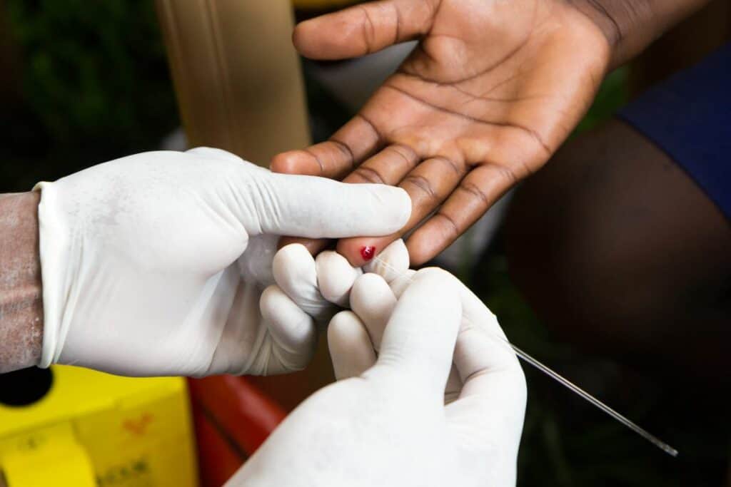 Finger prick test for HIV