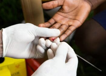 Finger prick test for HIV